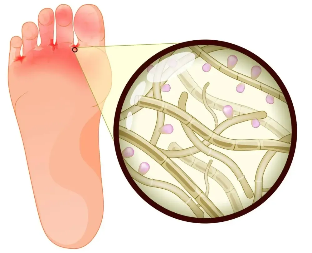 Foot care profile